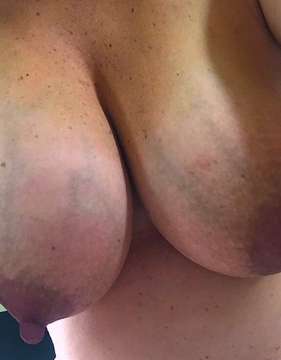 If My Wife Had Tits Like These She Would Never Get Them Reduced 10 of 45 pics
