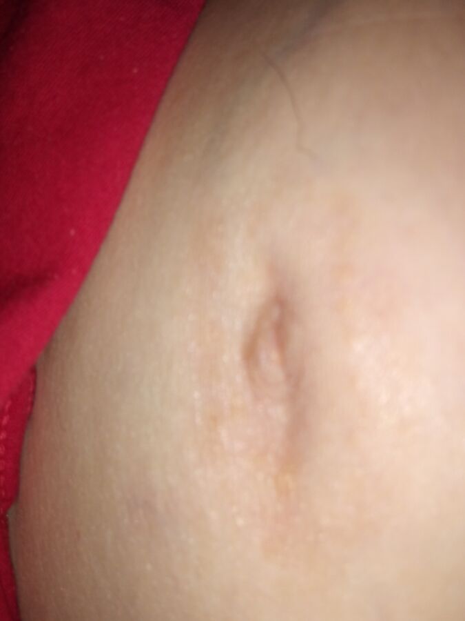 wifes inverted nipples 3 of 5 pics
