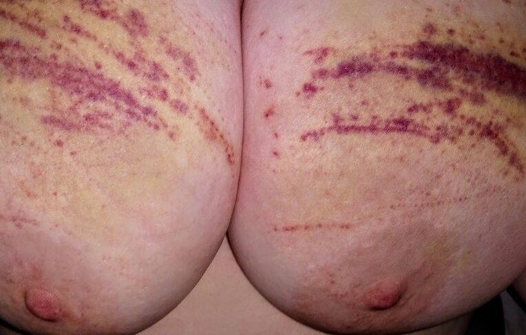 Abused Pig Tits 2 of 16 pics