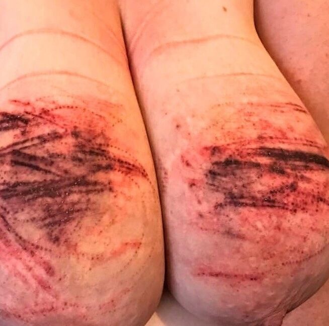 Abused Pig Tits 3 of 16 pics