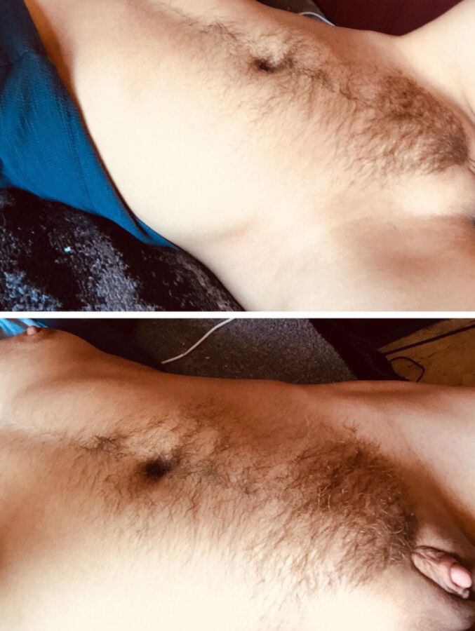 Hairy Ftm 9 of 16 pics