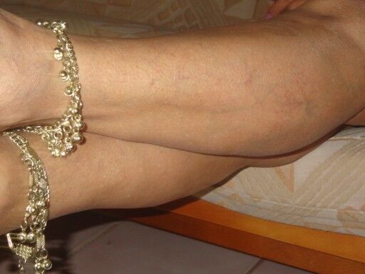 You know I love Ankle Bracelets 15 of 42 pics