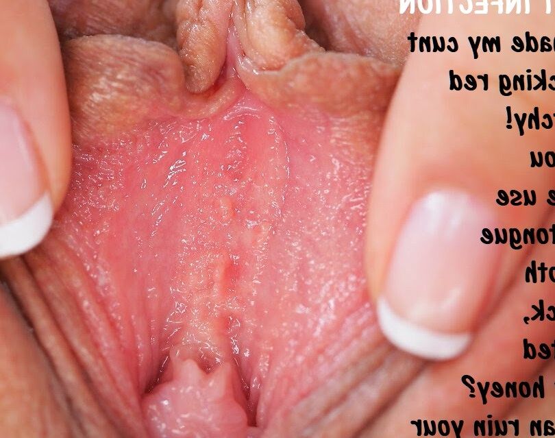 **WARNING: The SICKEST stuff: Yeast, Smegma, extreme FITLH! 19 of 46 pics