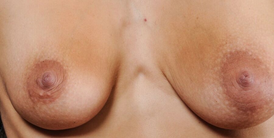 Repositioned stitched nipples. 20 of 35 pics