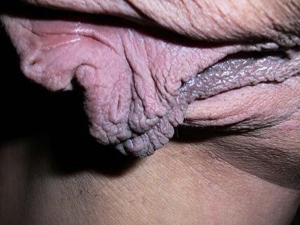 Meaty labia 15 of 84 pics