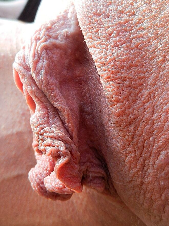 Meaty Labia Pics