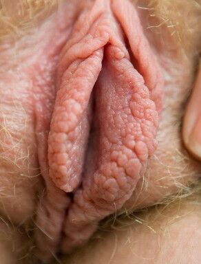 Meaty labia 20 of 84 pics