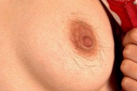 Hairy nipples 3 of 48 pics