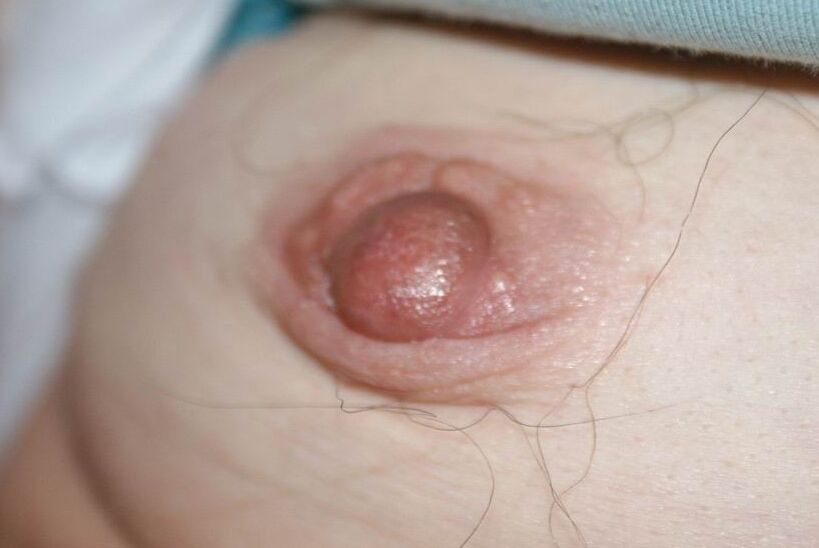 Hairy nipples 2 of 48 pics