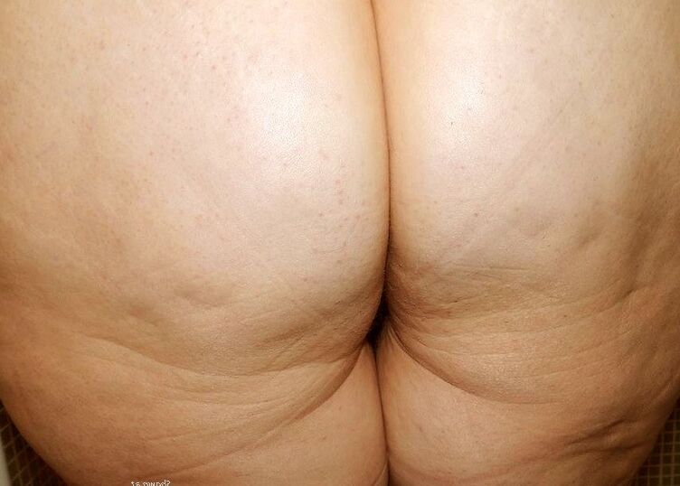 She is a hot hairy BBW with cellulite 1 of 11 pics