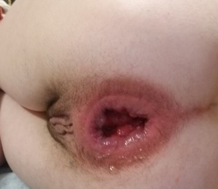 MY NEW ANAL EXPERIMENT 6 of 8 pics