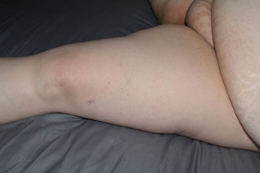 Right Female Leg 1 of 6 pics