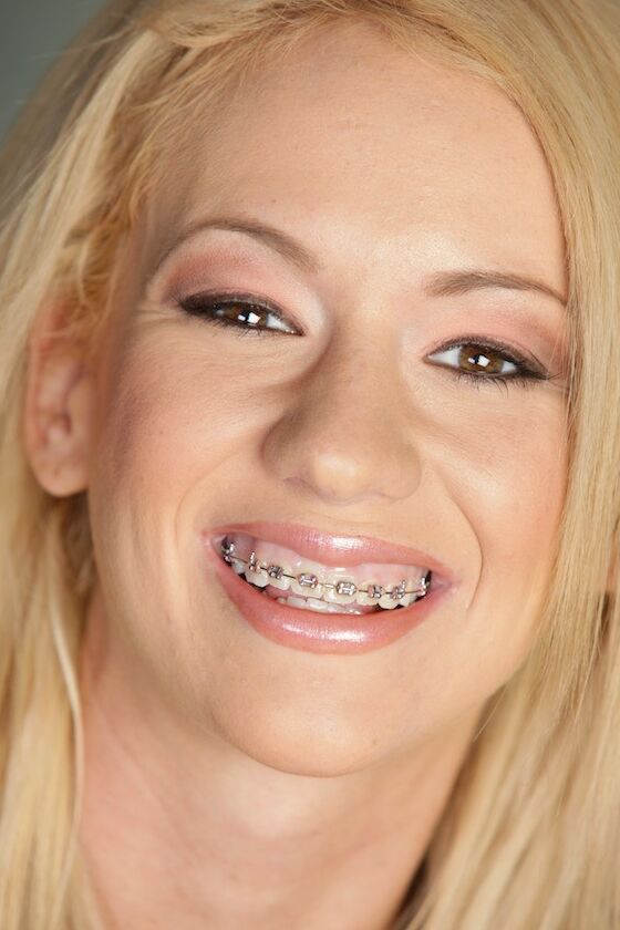 randy blonde with braces has damp places for something sensitive 24 of 462 pics