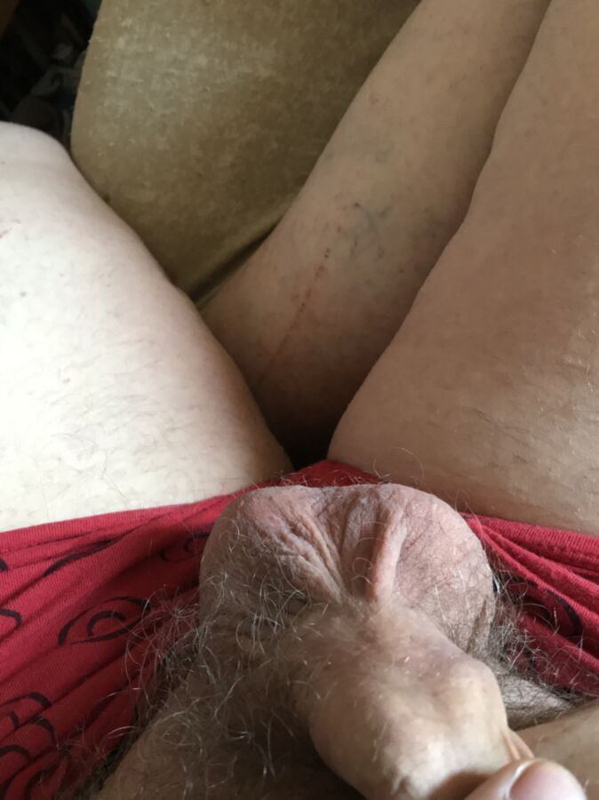 My willy 20 of 25 pics