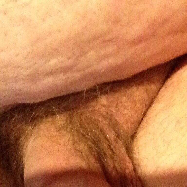 My willy 1 of 25 pics