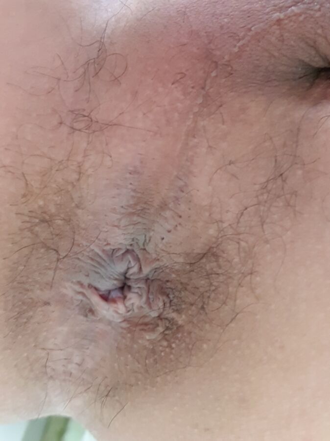Butthole 10 of 47 pics