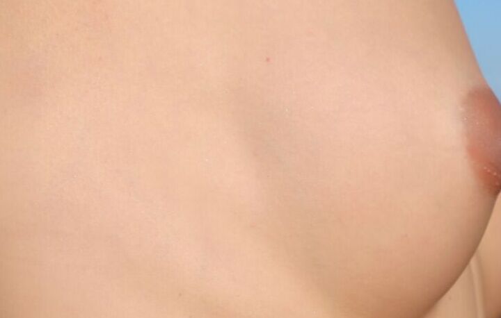 nipples 16 of 21 pics