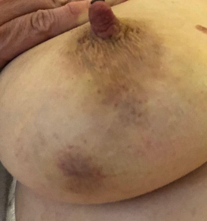 My Sexy MILF Girlfriend Bound, Bruised, Used 21 of 177 pics