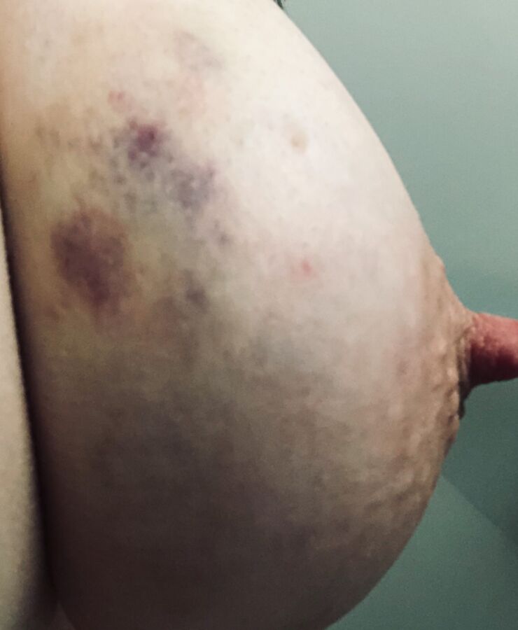 My Sexy MILF Girlfriend Bound, Bruised, Used 23 of 177 pics