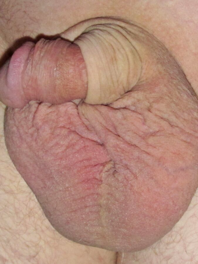 Extrem kleiner penis