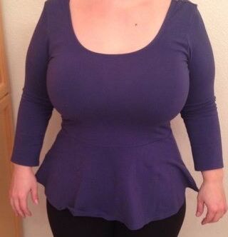 breast reduction 1 of 5 pics