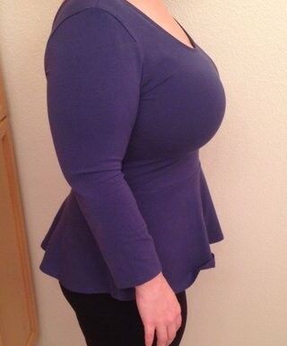 breast reduction 3 of 5 pics
