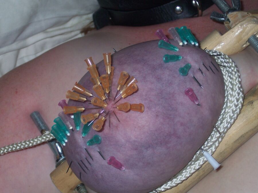 Needles in nipple 4 of 11 pics