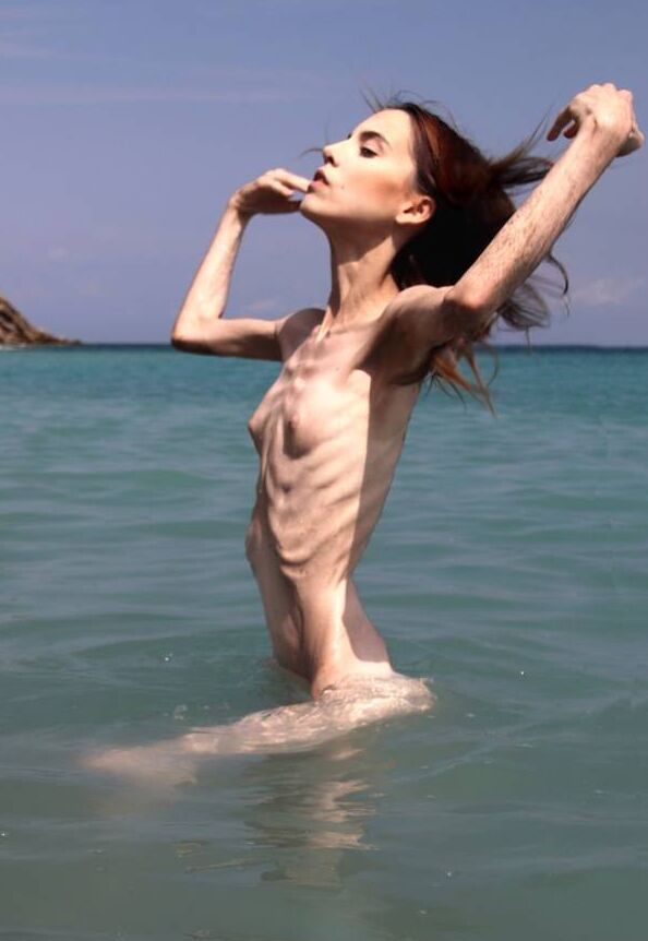 Anorexic Model, Wilkomira  15 of 90 pics