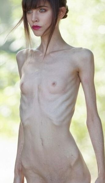 Anorexic Fetish