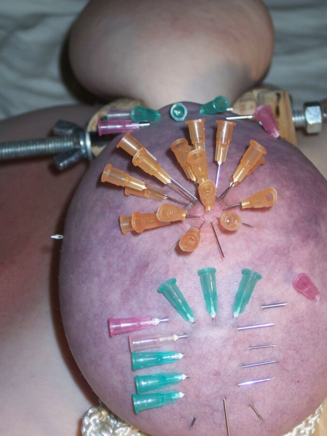Needles in nipple 11 of 11 pics