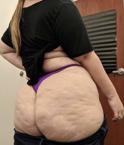 Love Cellulite  6 of 7 pics