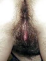 More hairy arses 19 of 24 pics
