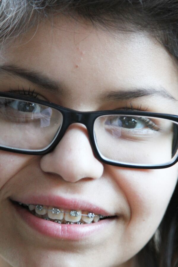 Cute Teen with Braces and Glasses 2 of 15 pics