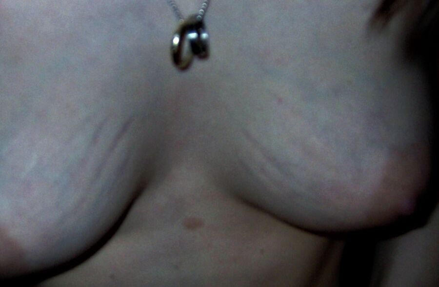 Young Girl with heavy stretchmarks and huge areolas 22 of 55 pics