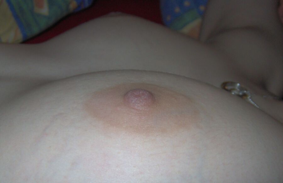 Young Girl with heavy stretchmarks and huge areolas 12 of 55 pics