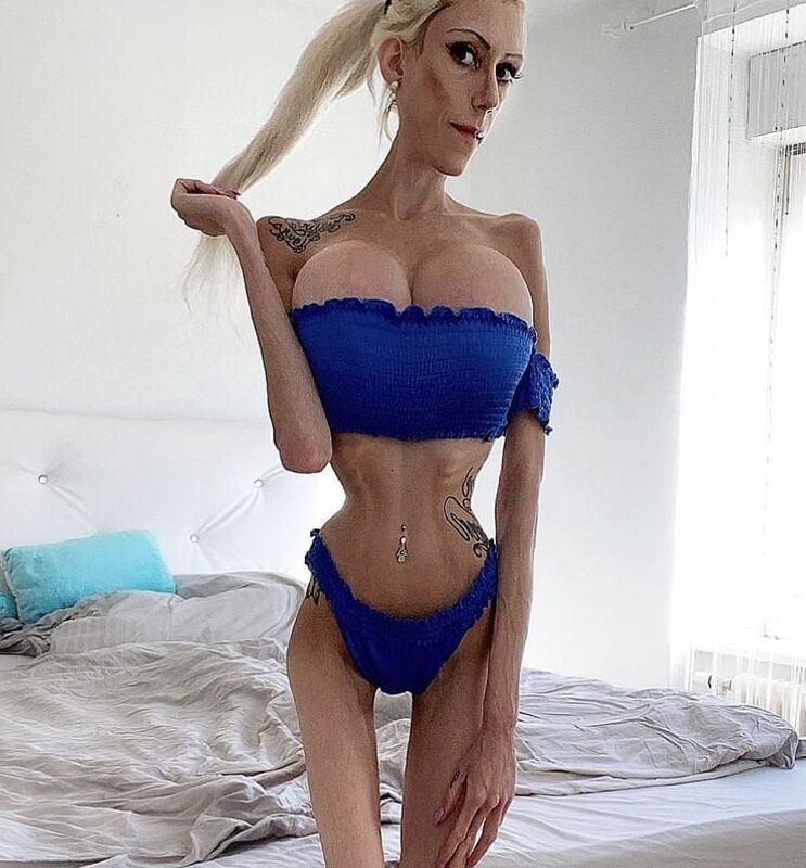 Anorexic Fetish